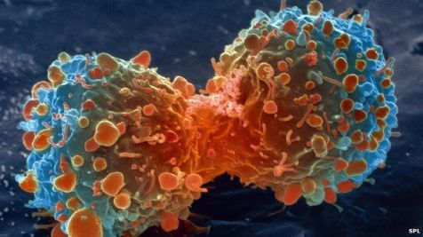 cancer cell