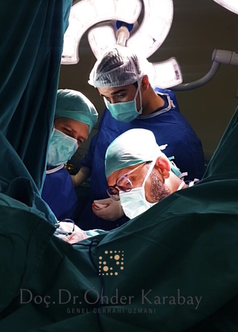 Hemoroid tedavisi İstanbul Doç Dr Önder Karabay